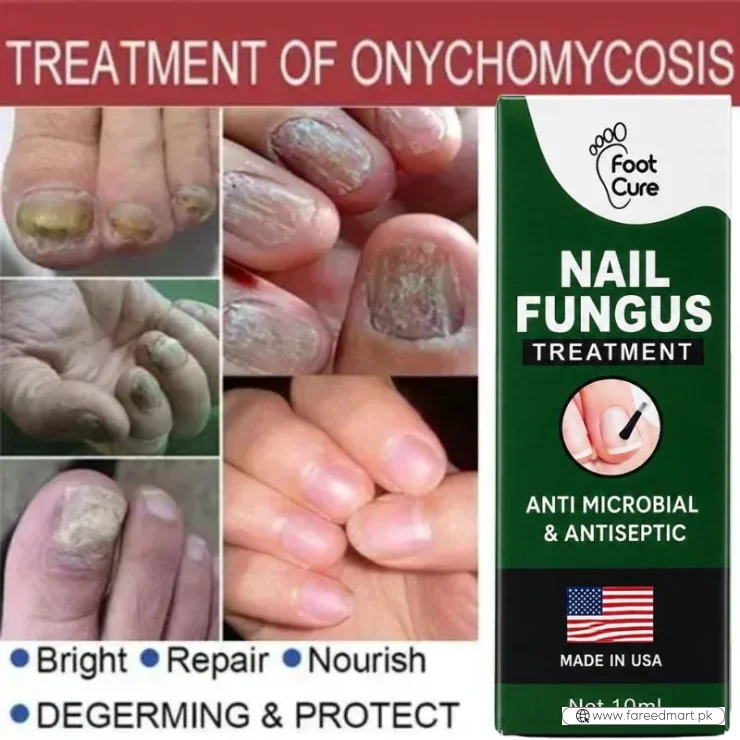 Fast Nail Fungus Treatment Serum | Nail Repair Essence for Fingernails & Toenails | Natural Nail Care Formula