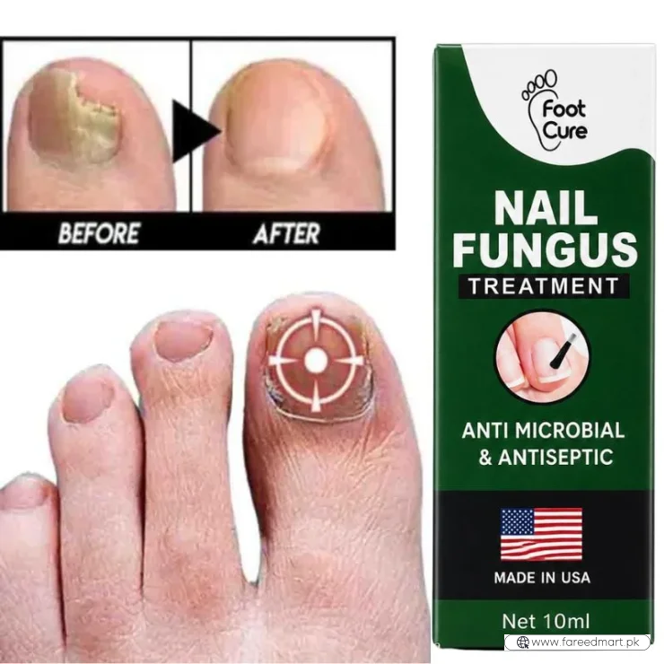 Fast Nail Fungus Treatment Serum | Nail Repair Essence for Fingernails & Toenails | Natural Nail Care Formula