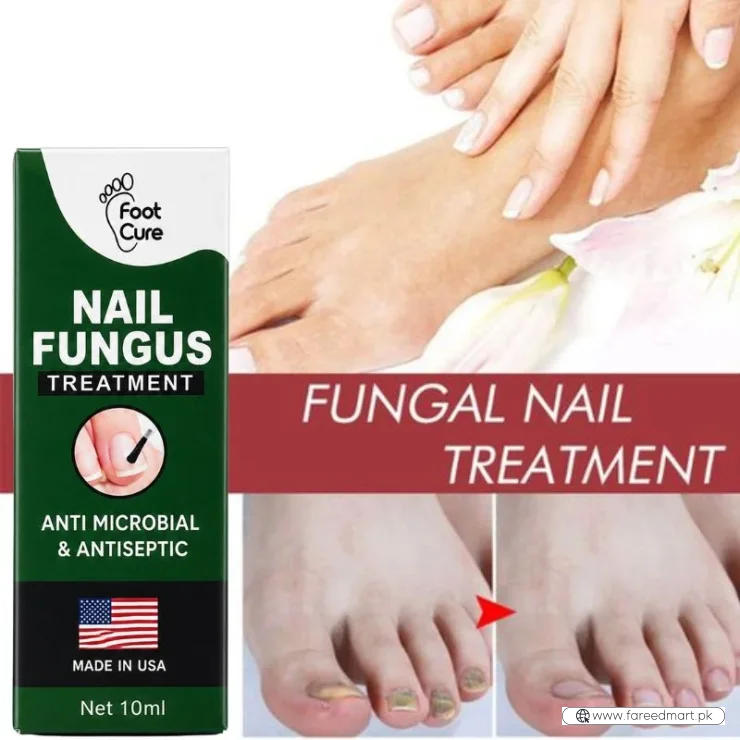 Fast Nail Fungus Treatment Serum | Nail Repair Essence for Fingernails & Toenails | Natural Nail Care Formula