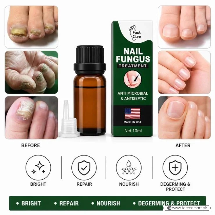 Fast Nail Fungus Treatment Serum | Nail Repair Essence for Fingernails & Toenails | Natural Nail Care Formula