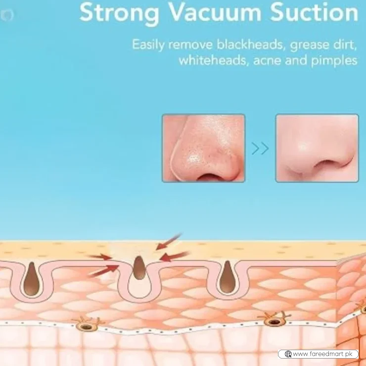 Rechargeable Blackhead Remover Vacuum Cleaner | Model FPLS-001 | Deep Pore Cleansing & Microdermabrasion Device
