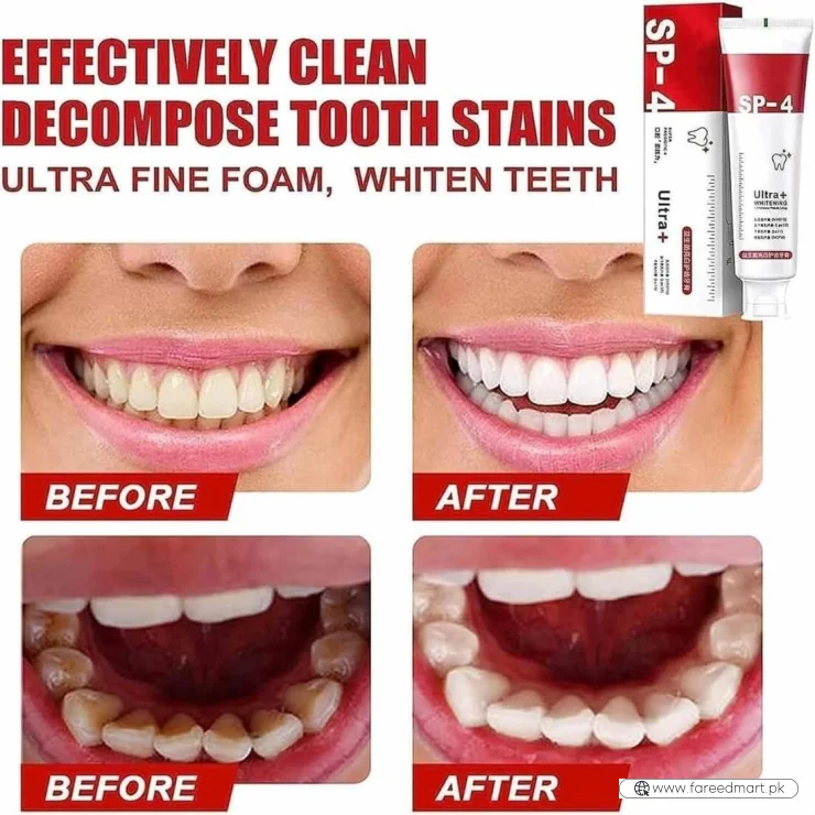 Yayashi SP-4 Ultra Whitening Toothpaste | Stain Remover & Fresh Breath Formula